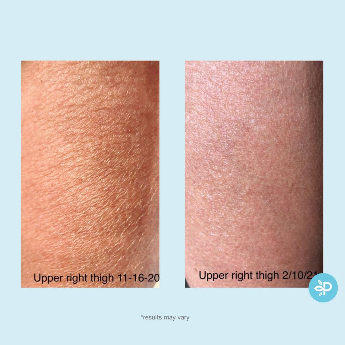Gly + Sal Exfoliating Body Lotion
