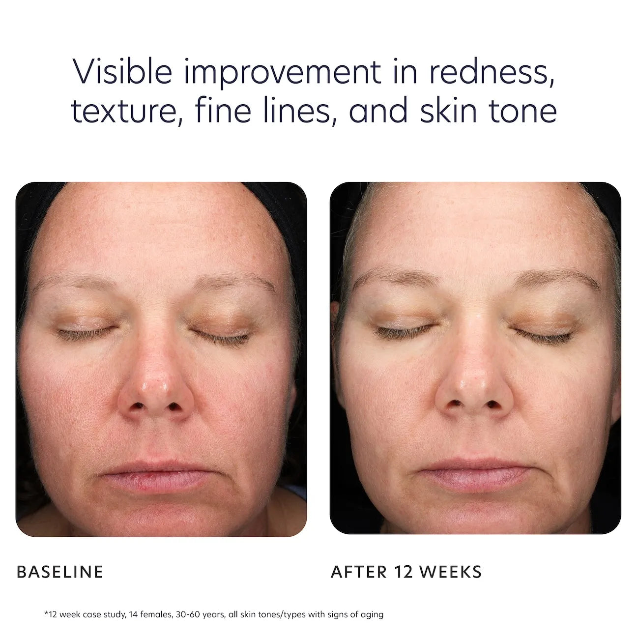 Triple Exfoliation Peel Pads