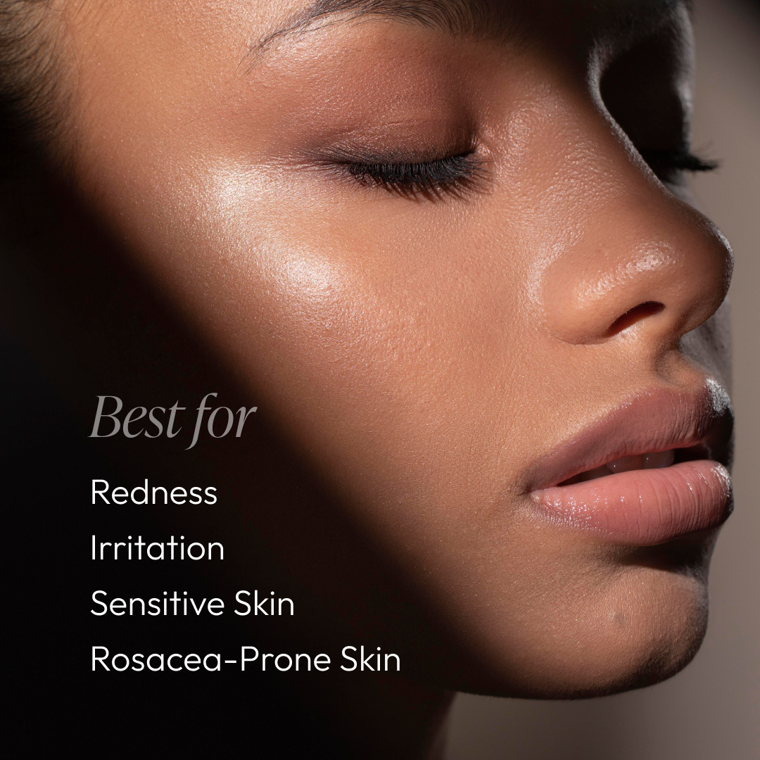 Aloe & Calendula Calming Mist